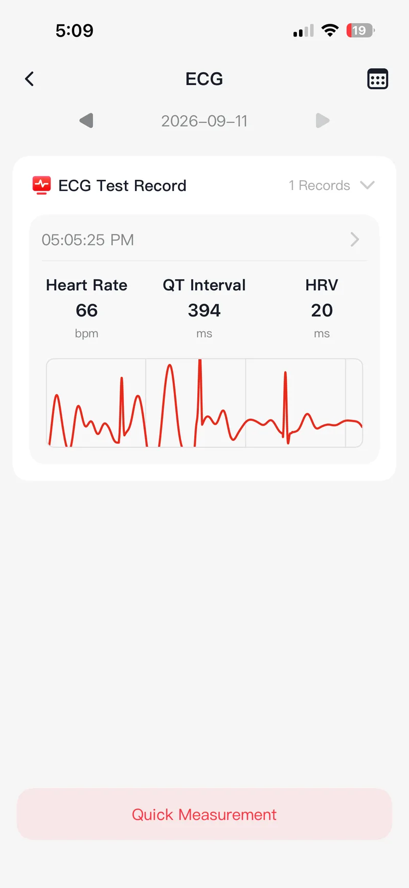 The G band ECG screen: a saved recording with heart rate, QT interval and HRV above the trace